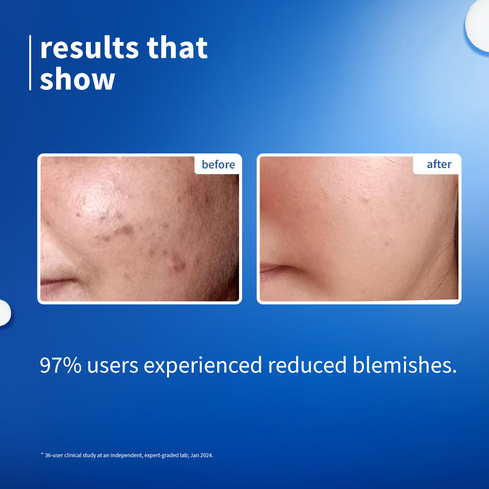 10% Niacinamide & Rice Water Brightening Face Serum